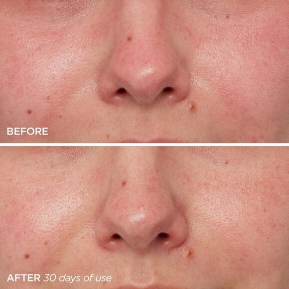 The Daily  SERUM NIP - Picture 9 of 9